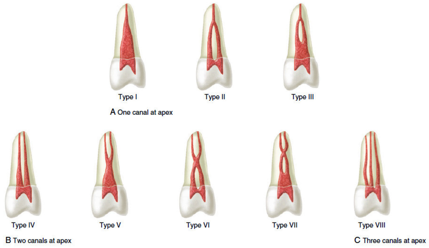 maxillary first premolar canals