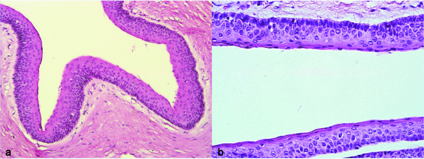 odontogenic keratocyst histology